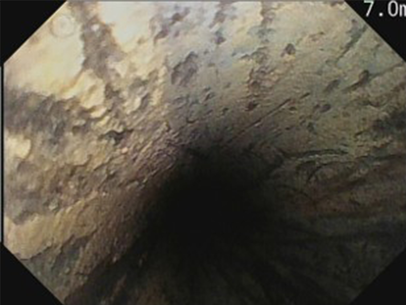 給水管