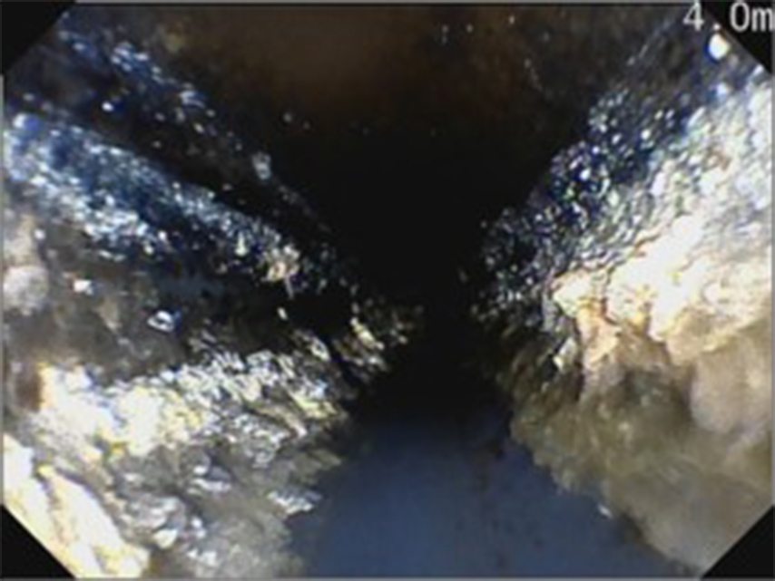 排水管