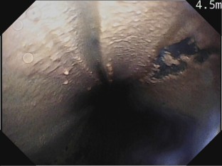 共用部排水管